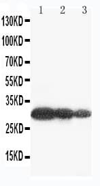 AQP6 / Aquaporin 6 Antibody (aa264-282)