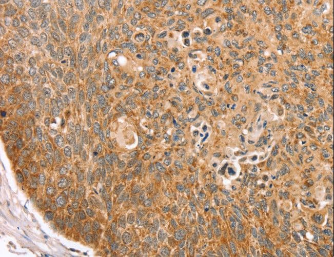 TRIM62 Antibody