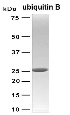 Human UBB / Ubiquitin B Protein (Recombinant 6His, N-terminus)