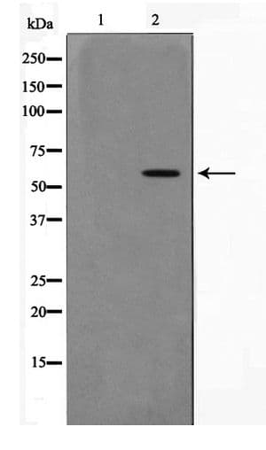 AKT1 Antibody (phospho-Thr308)