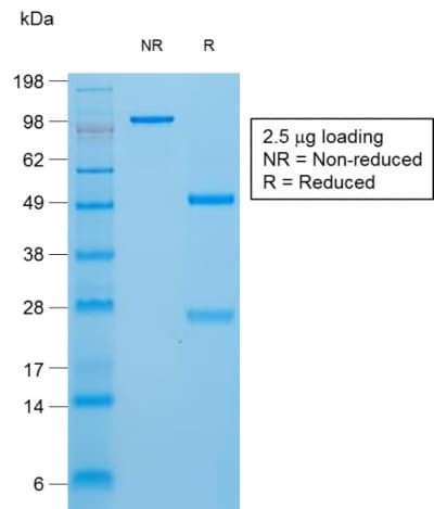 TG / Thyroglobulin Antibody (clone TGB/1970R)