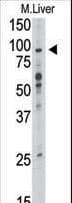 Polyclonal Rabbit anti-Human TLR6 Antibody (aa393-423, IHC, WB)
