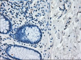 Monoclonal Mouse anti-Human IRF3 Antibody (clone OTI2G3, IHC, IF, WB)