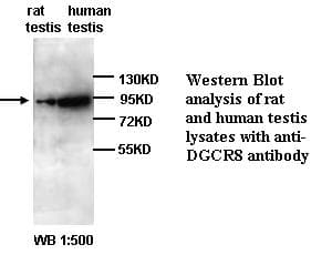 Polyclonal Rabbit anti-Human DGCR8 Antibody (WB)