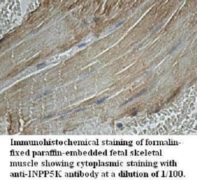 IHC-plus™ INPP5K / SKIP Antibody (aa183-430)