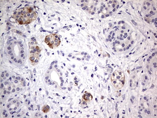 Monoclonal Mouse anti-Human DICER1 / Dicer Antibody (clone OTI1D9, aa1666-1922, IHC)