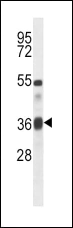 TGFB1 / TGF Beta 1 Antibody (aa22-50)