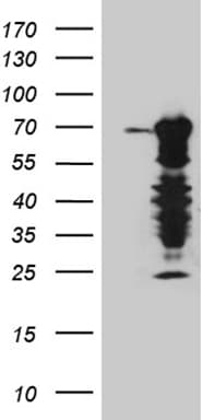 ELL / MEN Antibody (aa302-621, clone OTI1B5, Carrier-free)