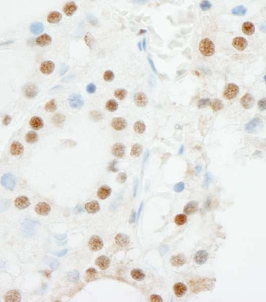 ZNF318 Antibody (aa2049-2099)