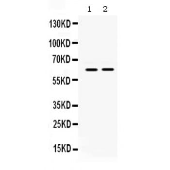 LOXL1 Antibody (aa397-425)