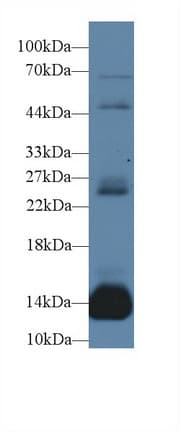 MB / Myoglobin Antibody (aa1-154)