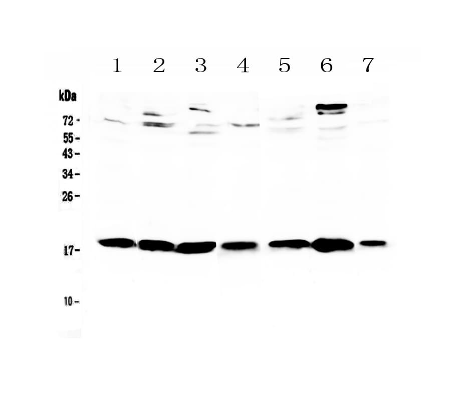 Polyclonal Rabbit anti-Rat WFDC2 / HE4 Antibody (IHC, WB)