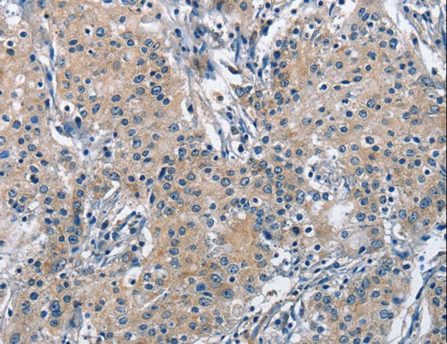 TRIP4 / ASC-1 Antibody