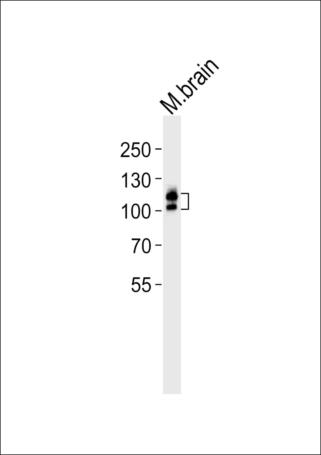 Polyclonal Rabbit anti-Human c-Kit / CD117 Antibody (aa336-367, WB)