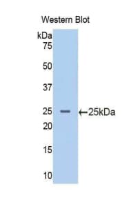 PIK3CB / PI3K Beta Antibody (aa524-703, APC)