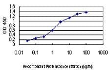 Monoclonal Mouse anti-Human FAK / Focal Adhesion Kinase Antibody (clone 2C3, WB)
