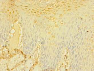 Polyclonal Rabbit anti-Human DNAM-1 / CD226 Antibody (IHC, WB)