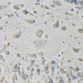ATP2A2 / SERCA2 Antibody