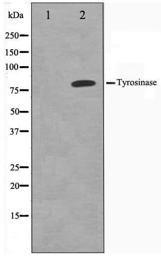 Polyclonal Rabbit anti-Human Tyrosinase Antibody (WB)