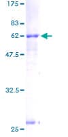 Human ACAT2 Protein (Recombinant GST)