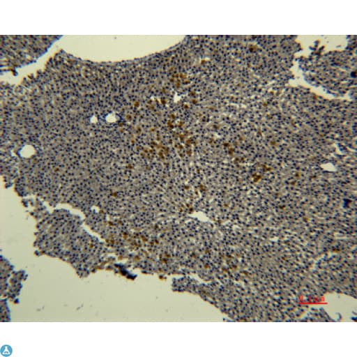 Monoclonal Mouse anti-Human TF / Transferrin Antibody (IHC, WB)