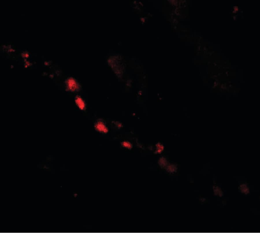 PTCHD2 Antibody