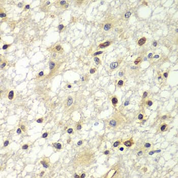 Polyclonal Rabbit anti-Human ZBTB48 / HKR3 Antibody (IHC, WB)