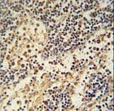 Polyclonal Rabbit anti-Human HEMK1 Antibody (aa311-338, IHC, WB)