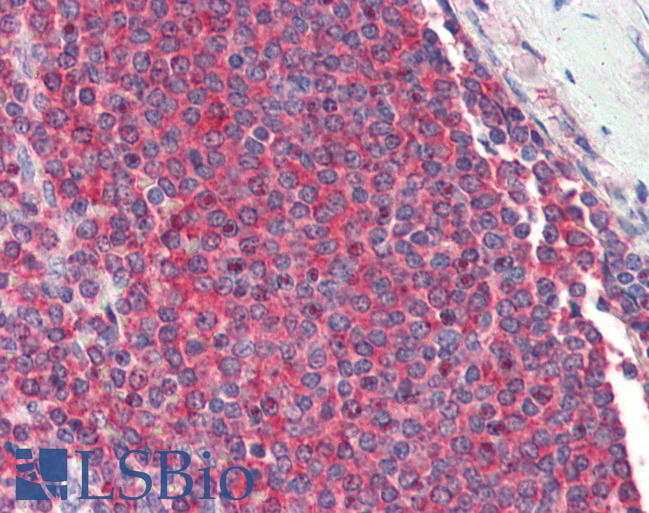 IHC-plus™ RPL8 / Ribosomal Protein L8 Antibody (aa181-195)
