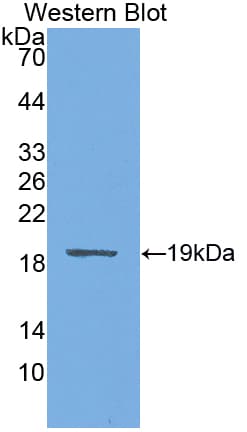 Preprovasopressin Antibody (aa21-164, Biotin)
