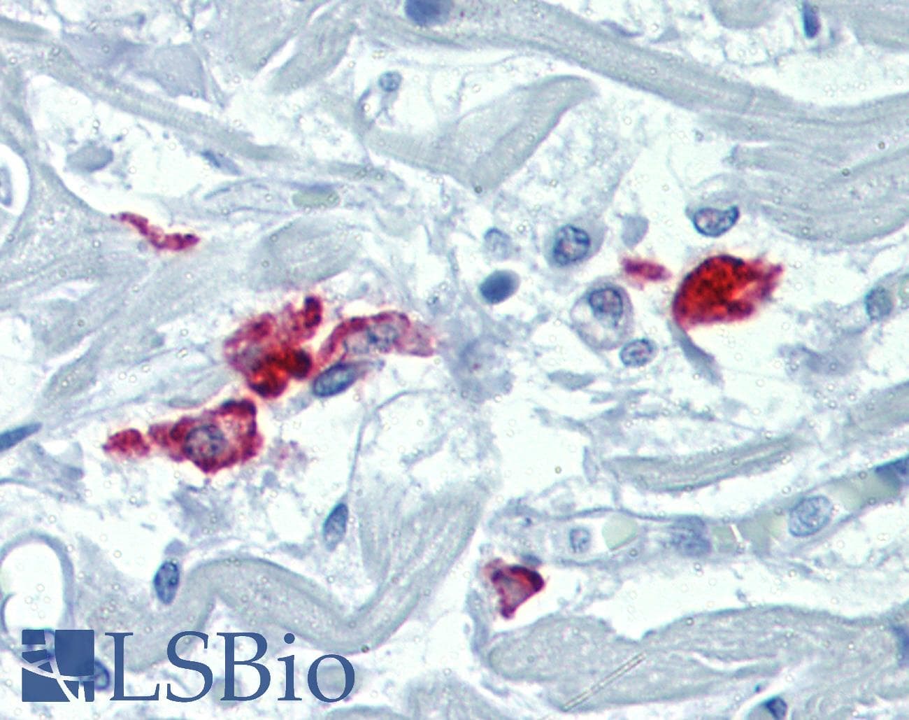 IHC-plus™ Monoclonal Rat anti-Human CD209 / DC-SIGN Antibody (clone h209, IHC)
