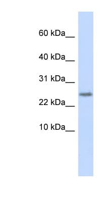 CST9 Antibody (C-Terminus)