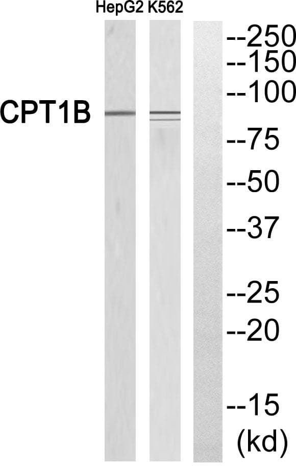 CPT1B Antibody