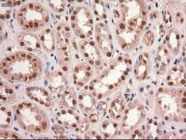 MYC / c-Myc Antibody (clone OTI5G3)