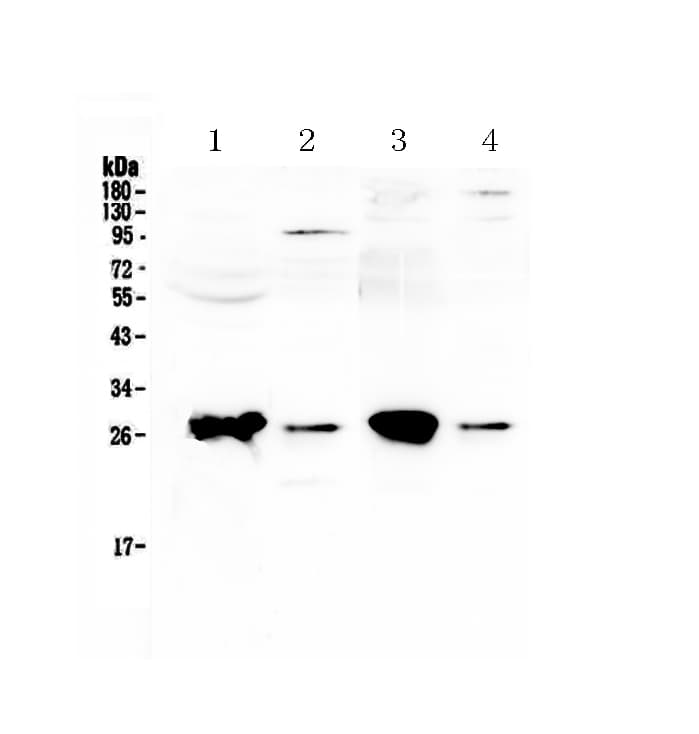 GSTT1 Antibody