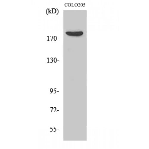 Polyclonal Rabbit anti-Human CDC42BPB / MRCKB Antibody (1610-1690 aa, C-terminal, IHC, WB)