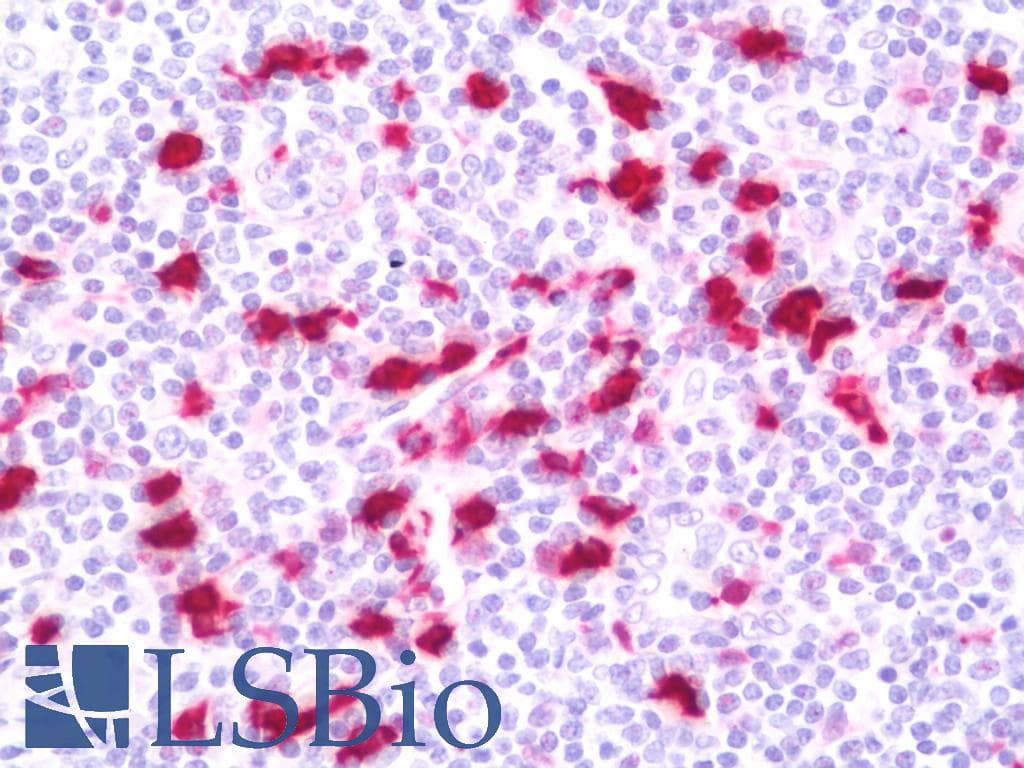 IHC-plus™ ABCC10 Antibody (aa816-865)