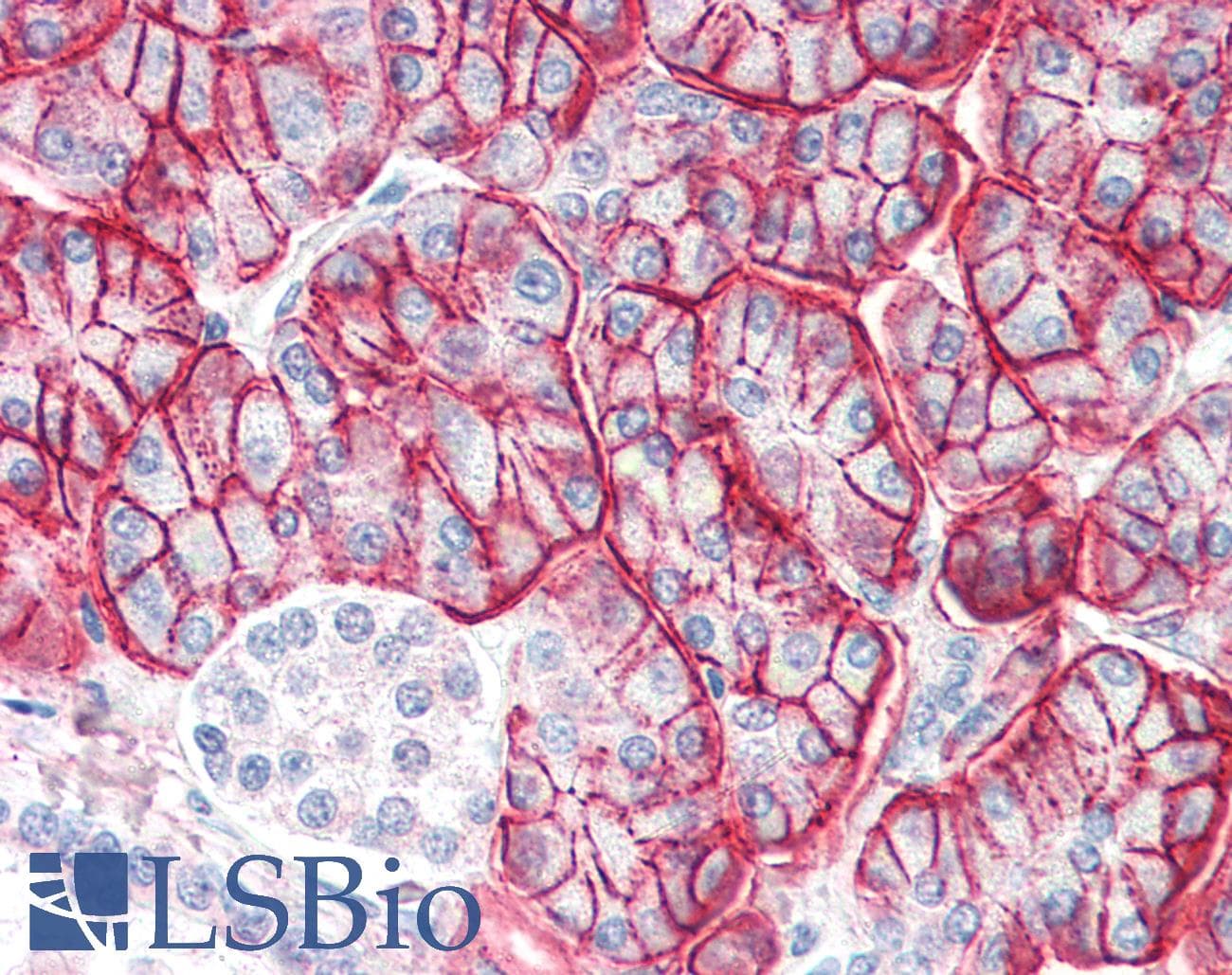 IHC-plus™ Polyclonal Goat anti-Human ENPP1 Antibody (aa915-925, IHC)