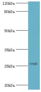 Polyclonal Rabbit anti-Human HBP17 / FGFBP1 Antibody (aa22-232, IHC, WB)
