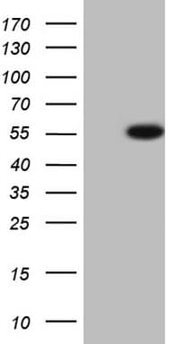 BFSP2 Antibody (aa184-415, clone OTI2B7)