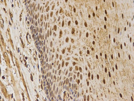 MAPK7 / ERK5 Antibody