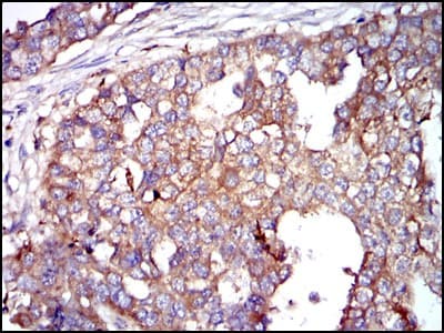G6PDH Antibody (clone 2H7)
