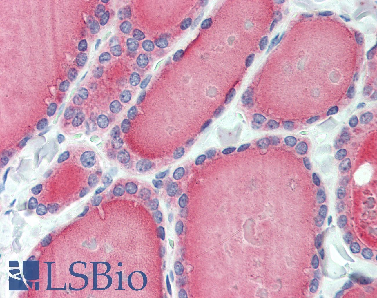 IHC-plus™ ESYT1 Antibody (Internal)