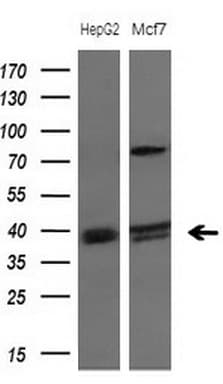 DJ858B16.2 / PISD Antibody (aa80-340, clone OTI2H1)