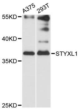 Polyclonal Rabbit anti-Human STYXL1 Antibody (WB)