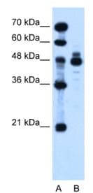 Polyclonal Rabbit anti-Human IHH Antibody (aa24-73, IHC, WB)
