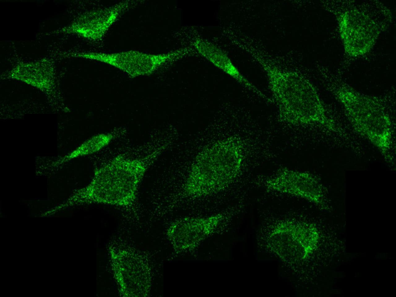 Polyclonal Rabbit anti-Human VEGF 121 Antibody (Preservative Free, IHC, IF)
