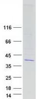 Human CCDC34 Protein (Recombinant Myc-DDK (Flag))