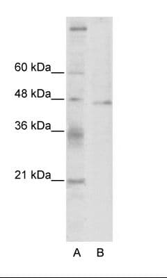 TSG101 Antibody (C-Terminus, HRP)