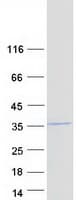 Human COPS7A Protein (Recombinant Myc-DDK (Flag))
